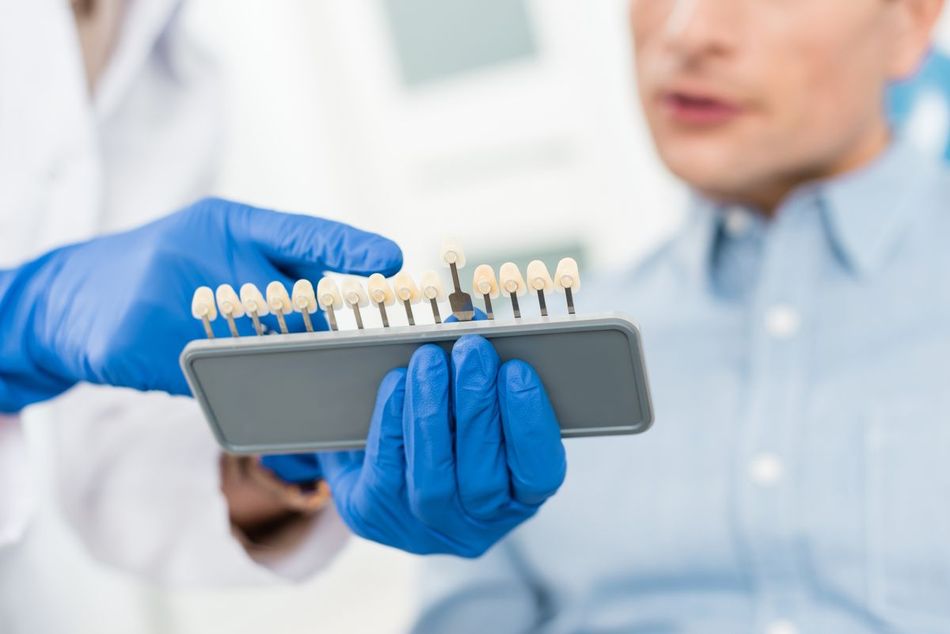 Cliente de clínica dental eligiendo el tono para sus implantes